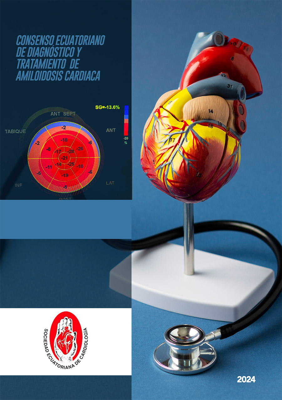 Consenso Ecuatoriano de Diagnóstico y Tratamiento de Amiloidosis Cardíaca