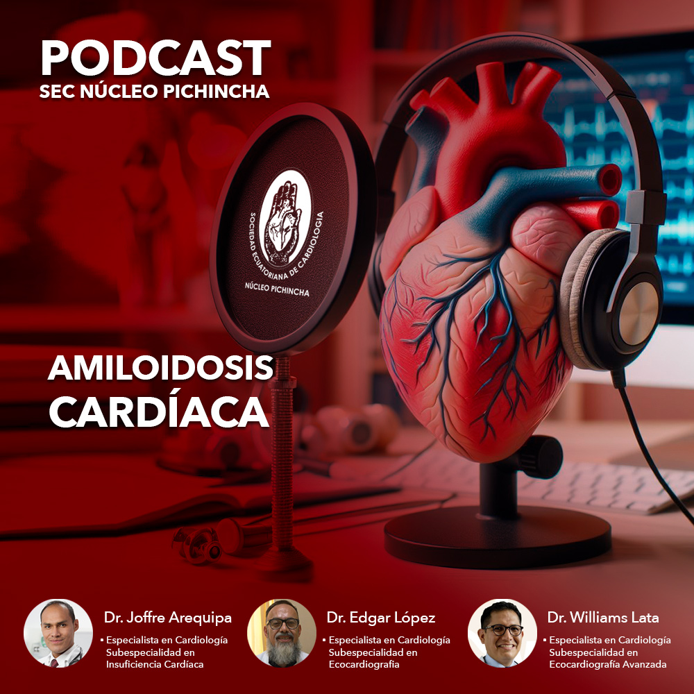 Amiloidosis Cardíaca