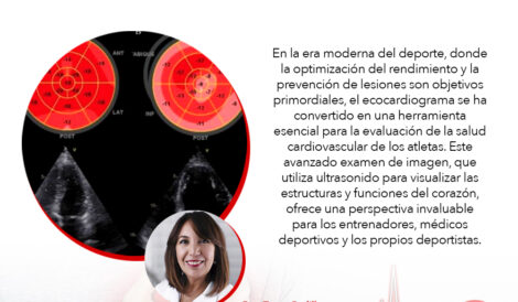 Relevancia del Ecocardiograma en el Deportista