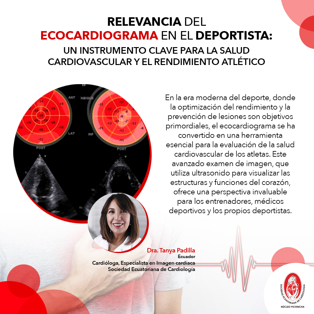 Relevancia del Ecocardiograma en el Deportista