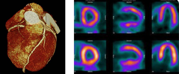 la IA puede ayudar a monitorear la progresión de la enfermedad a través del análisis continuo de imágenes ecocardiográficas y de otros datos clínicos