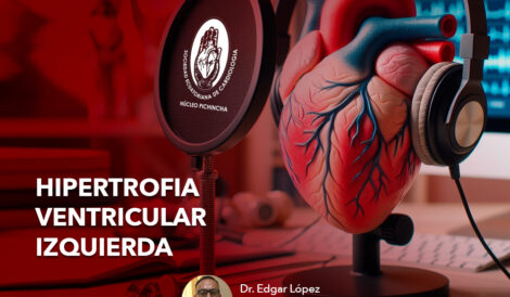 Hipertrofia Ventricular Izquierda